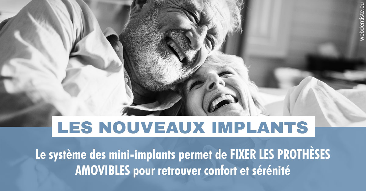 https://dr-olivier-godiveau.chirurgiens-dentistes.fr/Les nouveaux implants 2
