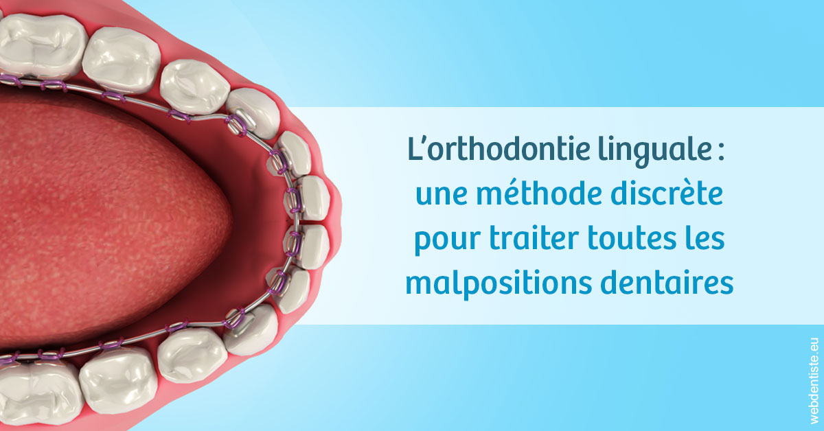 https://dr-olivier-godiveau.chirurgiens-dentistes.fr/L'orthodontie linguale 1