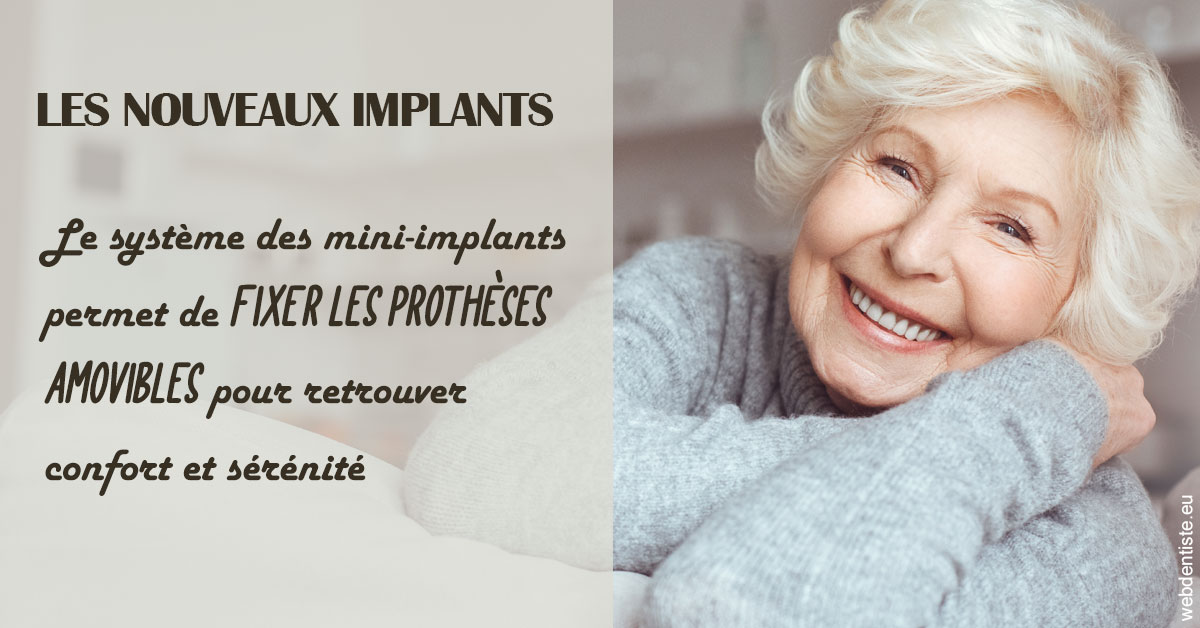 https://dr-olivier-godiveau.chirurgiens-dentistes.fr/Les nouveaux implants 1