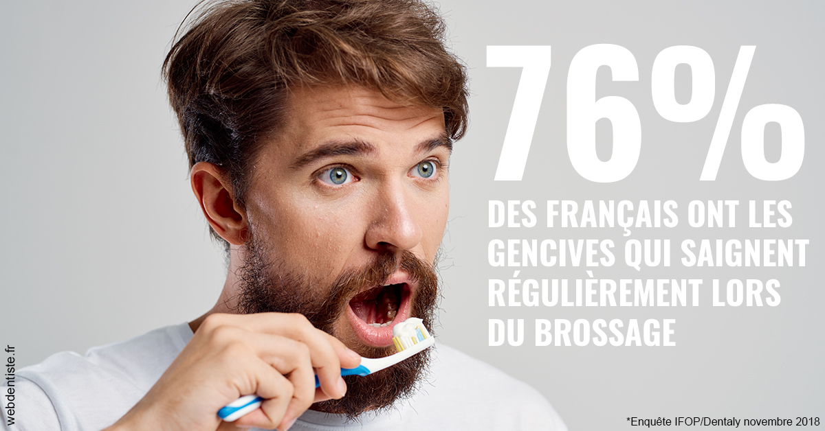 https://dr-olivier-godiveau.chirurgiens-dentistes.fr/76% des Français 2
