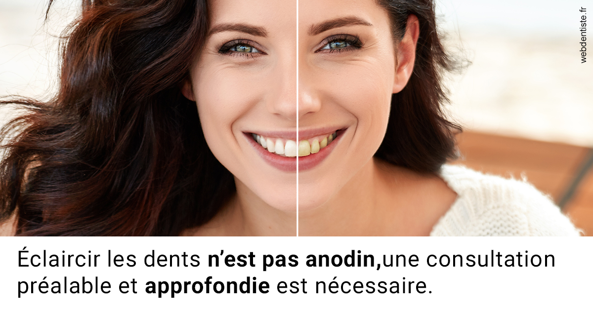 https://dr-olivier-godiveau.chirurgiens-dentistes.fr/Le blanchiment 2