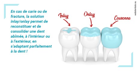 https://dr-olivier-godiveau.chirurgiens-dentistes.fr/L'INLAY ou l'ONLAY