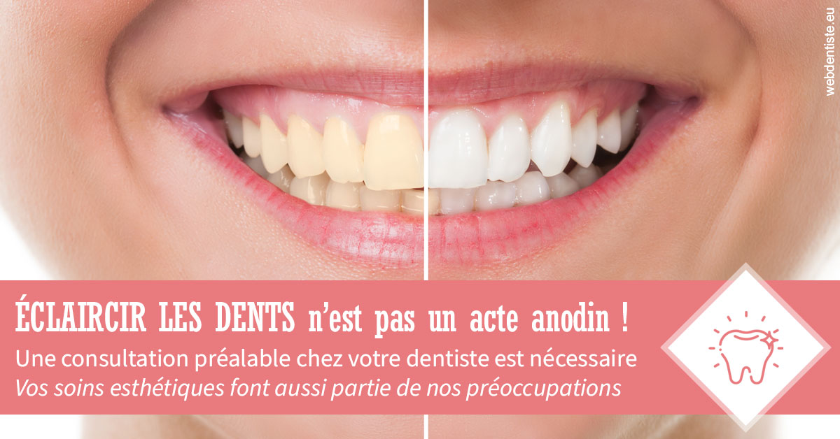 https://dr-olivier-godiveau.chirurgiens-dentistes.fr/Eclaircir les dents 1