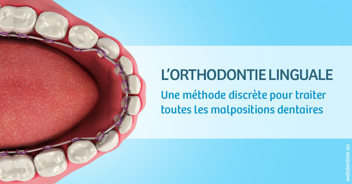 https://dr-olivier-godiveau.chirurgiens-dentistes.fr/L'orthodontie linguale 1