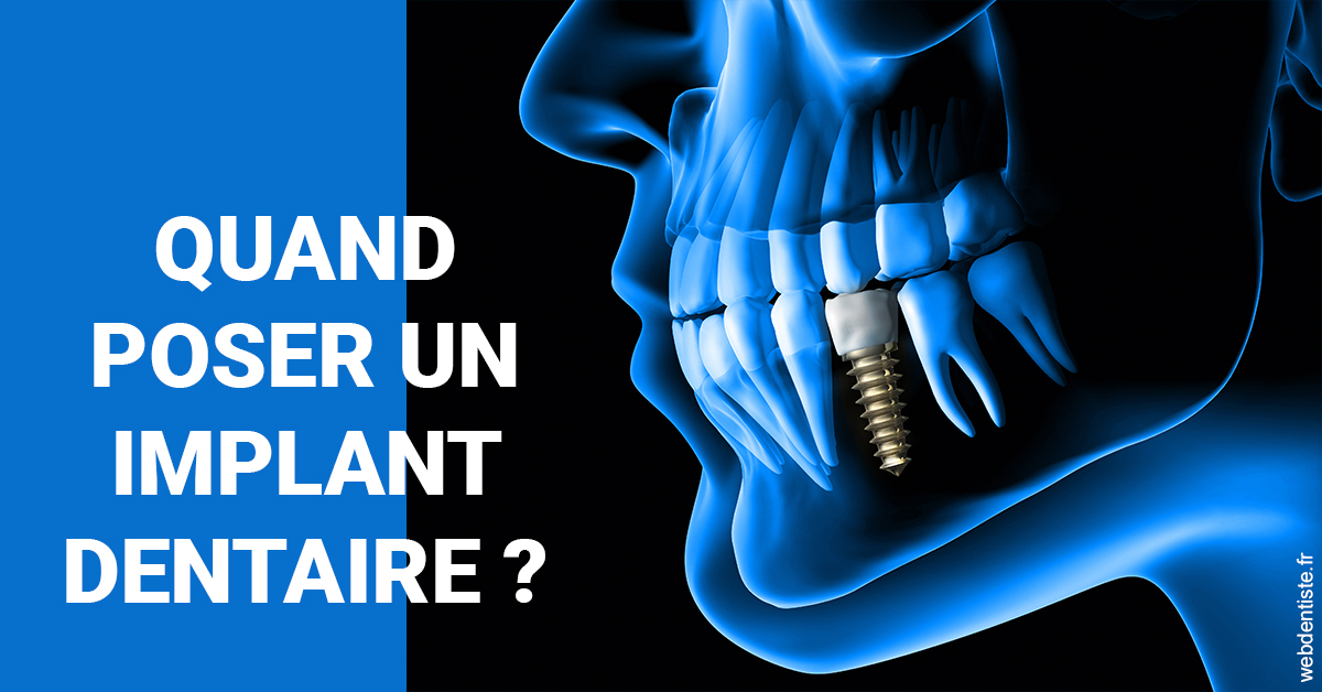 https://dr-olivier-godiveau.chirurgiens-dentistes.fr/Les implants 1