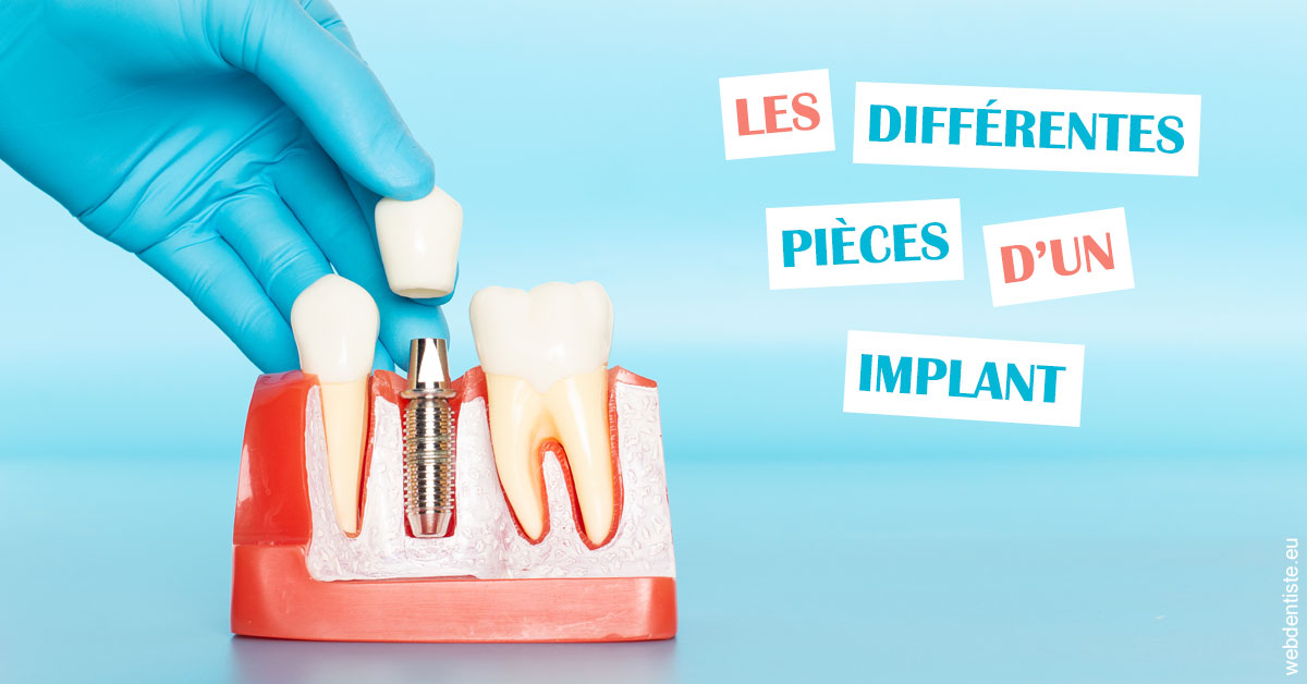 https://dr-olivier-godiveau.chirurgiens-dentistes.fr/Les différentes pièces d’un implant 2