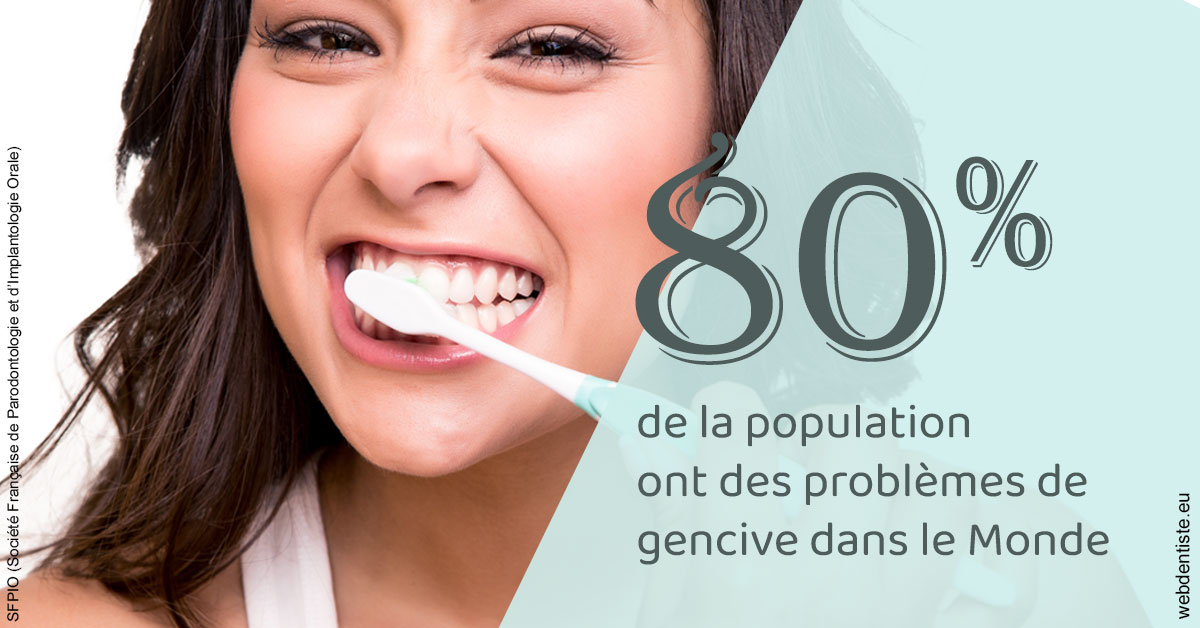 https://dr-olivier-godiveau.chirurgiens-dentistes.fr/Problèmes de gencive 1