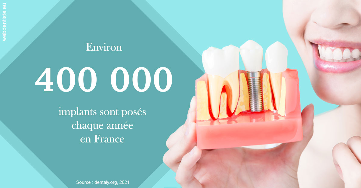 https://dr-olivier-godiveau.chirurgiens-dentistes.fr/Pose d'implants en France 2