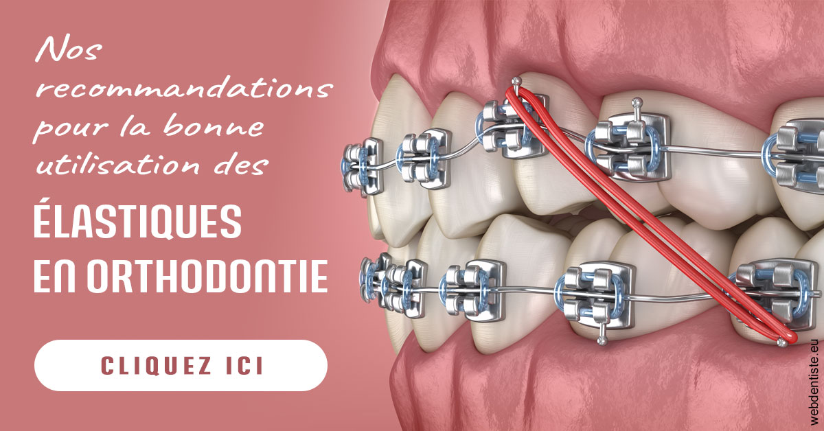https://dr-olivier-godiveau.chirurgiens-dentistes.fr/Elastiques orthodontie 2